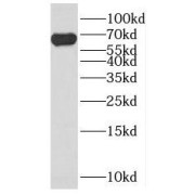 WB analysis of HeLa cells, using PARP2 antibody (1/2000 dilution).