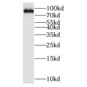 WB analysis of HeLa cells, using PARP9 antibody (1/500 dilution).