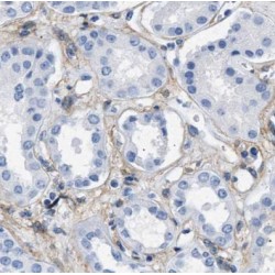 Parvin Alpha (PARVA) Antibody