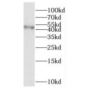 WB analysis of human liver tissue, using PARVA antibody (1/500 dilution).