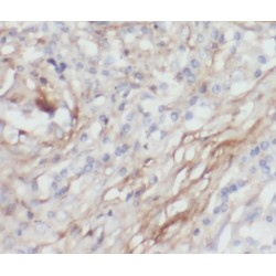 Parvin Gamma (PARVG) Antibody