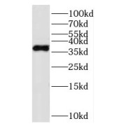 WB analysis of HL-60 cells, using PARVG antibody (1/500 dilution).