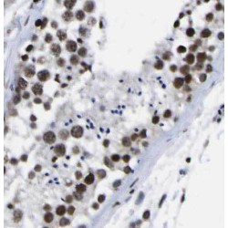 PAS Domain-Containing Serine/threonine-Protein Kinase (PASK) Antibody