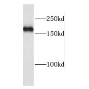 WB analysis of K-562 cells, using PASK antibody (1/1000 dilution).