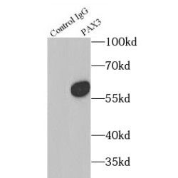 Paired Box 3 (PAX3) Antibody