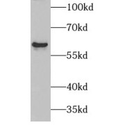 WB analysis of HEK-293 cells, using PAX3 antibody (1/1000 dilution).