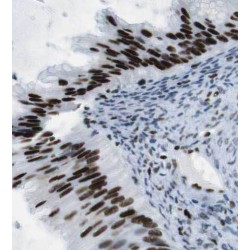 Paired Box 8 (PAX8) Antibody