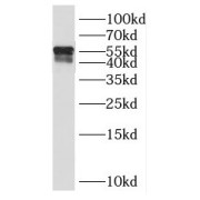 WB analysis of SKOV-3 cells, using PAX8 antibody (1/1000 dilution).