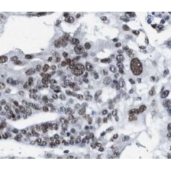 Paired Box 8 (PAX8) Antibody