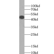 WB analysis of SKOV-3 cells, using PAX8 antibody (1/2000 dilution).