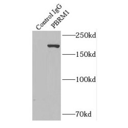 Protein Polybromo-1 (PBRM1) Antibody