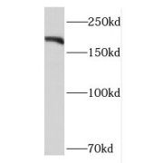 WB analysis of Jurkat cells, using PBRM1 antibody (1/500 dilution).