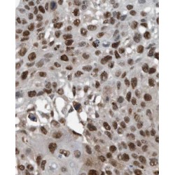 PBX Homeobox 3 (PBX3) Antibody