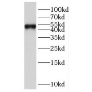 WB analysis of human lung tissue, using PBX3 antibody (1/500 dilution).