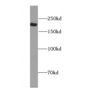 WB analysis of mouse brain tissue, using PC5 antibody (1/300 dilution).
