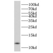 WB analysis of mouse pancreas tissue, using PCBD1 antibody (1/100 dilution).