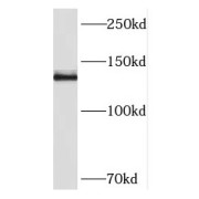 WB analysis of human brain tissue, using PCDH11X antibody (1/400 dilution).