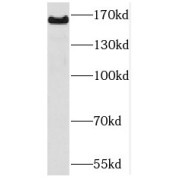 WB analysis of mouse brain tissue, using PCDH9 antibody (1/600 dilution).