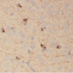 Protocadherin Alpha 3 (PCDHA3) Antibody