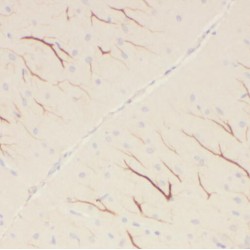 Protocadherin Alpha 5 (PCDHA5) Antibody