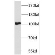 WB analysis of mouse brain tissue, using PCDHA5 antibody (1/1000 dilution).