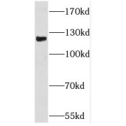 WB analysis of rat brain tissue, using PCDHA6 antibody (1/1000 dilution).