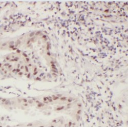 Phosphorylated CTD-Interacting Factor 1 (PCIF1) Antibody