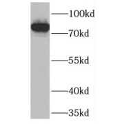 WB analysis of Jurkat cells, using PCIF1 antibody (1/800 dilution).