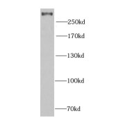 WB analysis of HeLa cells, using PCM1 antibody (1/1000 dilution).