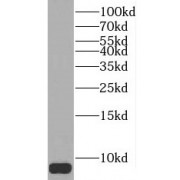 WB analysis of mouse brain tissue, using PCP4 antibody (1/300 dilution).