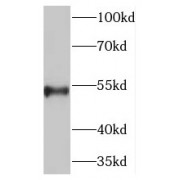 WB analysis of human testis tissue, using PCSK4 antibody (1/200 dilution).