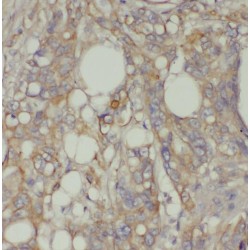 Proprotein Convertase Subtilisin/Kexin Type 7 (PCSK7) Antibody