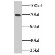 WB analysis of mouse spleen tissue, using PCSK7 antibody (1/300 dilution).