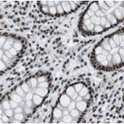 IHC-P analysis of human colon tissue, using PCYOX1 antibody (1/50 dilution).