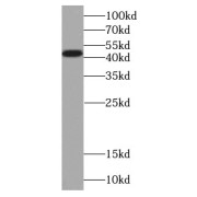 WB analysis of human placenta tissue, using PCYT1B antibody (1/500 dilution).