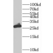 WB analysis of MCF7 cells, using PDAP1 antibody (1/800 dilution).