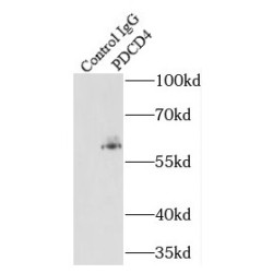 Programmed Cell Death Protein 4 (PDCD4) Antibody