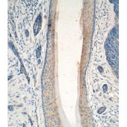 Programmed Cell Death Protein 5 (PDCD5) Antibody