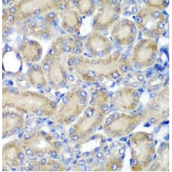 Programmed Cell Death Protein 6 (PDCD6) Antibody