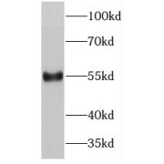 WB analysis of HeLa cells, using PDCD7 antibody (1/3000 dilution).