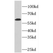 WB analysis of human brain tissue, using PDE1A antibody (1/500 dilution).