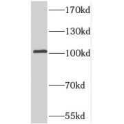 WB analysis of mouse brain tissue, using PDE2A antibody (1/1000 dilution).