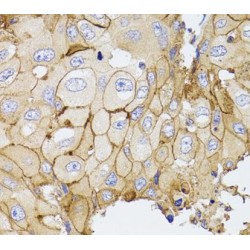 Phosphodiesterase 4D, cAMP Specific (PDE4D) Antibody