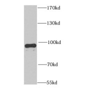 WB analysis of mouse brain tissue, using PED4D antibody (1/1000 dilution).