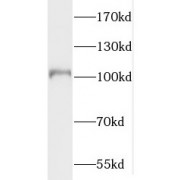 WB analysis of human brain tissue, using PDE6A antibody (1/500 dilution).