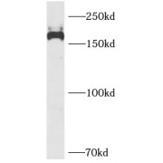 WB analysis of mouse lung tissue, using PDGFRB antibody (1/1000 dilution).