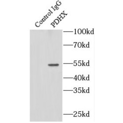 Pyruvate Dehydrogenase Complex Component X (PDHX) Antibody