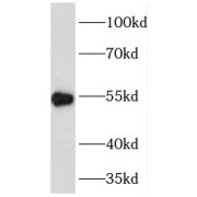 WB analysis of BxPC-3 cells, using PDHX antibody (1/5000 dilution).