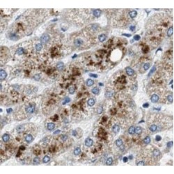 Pyruvate Dehydrogenase Kinase 1 (PDK1) Antibody