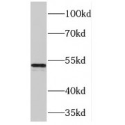 WB analysis of mouse liver tissue, using PDK1 antibody (1/2000 dilution).